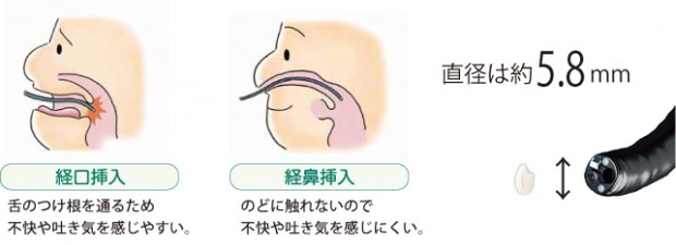 経口・経鼻の説明写真